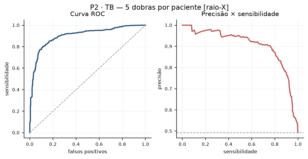 p2_tb_cv_roc_pr.png